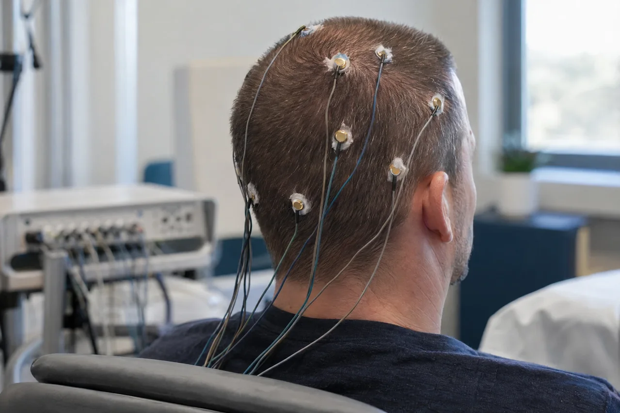 Illustrative EEG acquisition with small cup scalp electrodes, conductive paste and leads to an acquisition system.